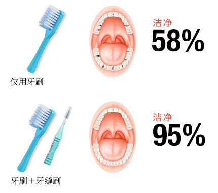 Plaque removal rate is improved to 95% by combination use with toothbrush!