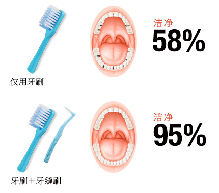 Plaque removal rate is improved to 95% by combination use with toothbrush!