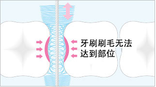 Plaque removal rate is improved to 95% by combination use with toothbrush!