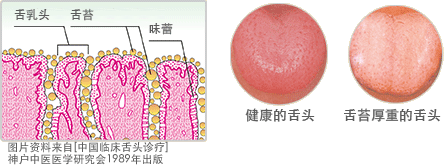 Abstracted from "Tongue Diagnosisnand Sphygmoscopy for Chinese Medicine clinic". Kobe Cinese Medicine Society, Ishiyaku Publishers, Inc. 1989.