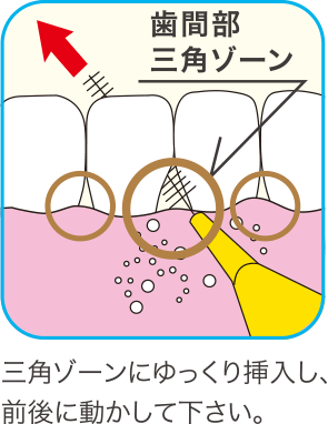 三角ゾーンにゆっくり挿入し、前後に動かして下さい。