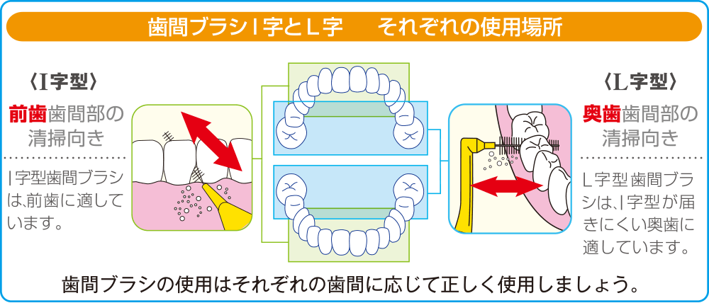 歯間ブラシの使い方｜歯間ブラシ・フロスピック - デンタルプロ株式会社